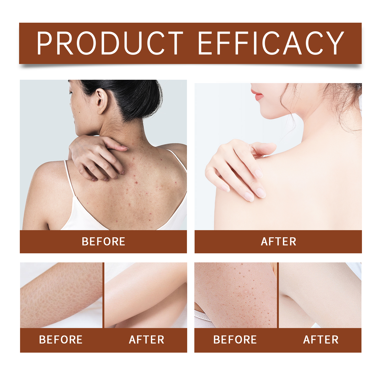 Luxury Body Oil for Dry Skin A - Luxury Skincare Cream บทวิจารณ์และราคา